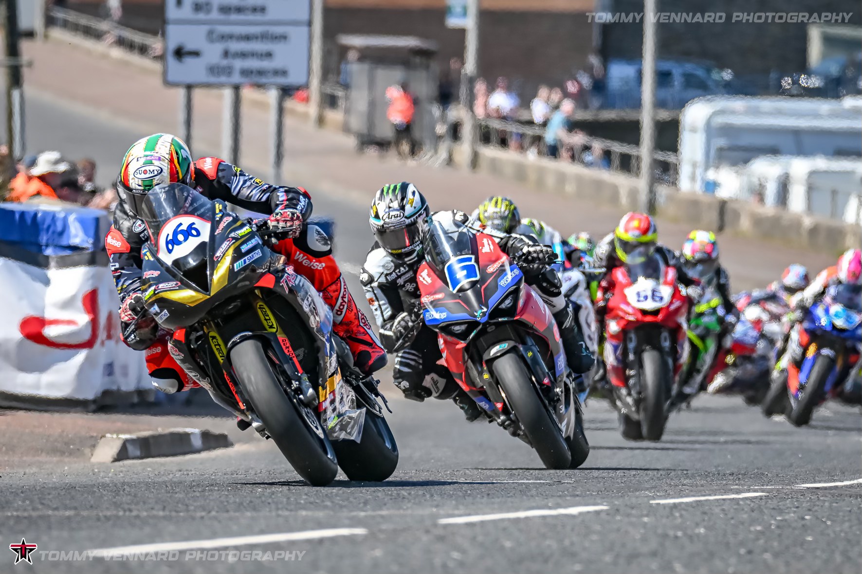 2026 NW200 Preview – Part 2 – Supersport Races